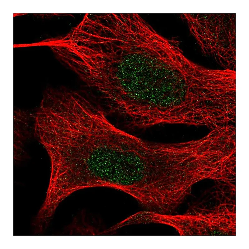 Atlas Antibodies Anti-TIA1 Antibody