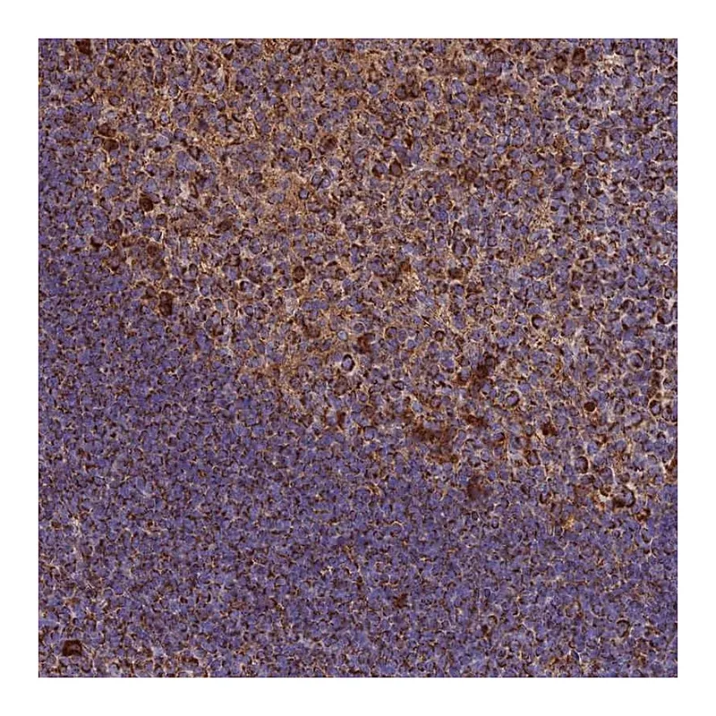 Atlas Antibodies Anti-THUMPD2 Antibody