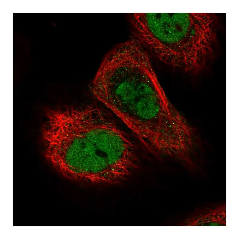Atlas Antibodies Anti-TICRR Antibody