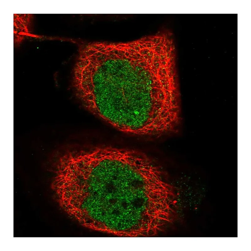 Atlas Antibodies Anti-TICRR Antibody