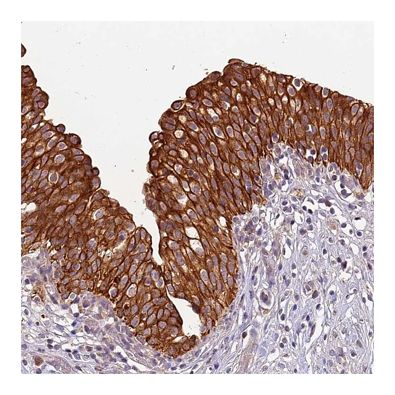 Atlas Antibodies Anti-TIGAR Antibody