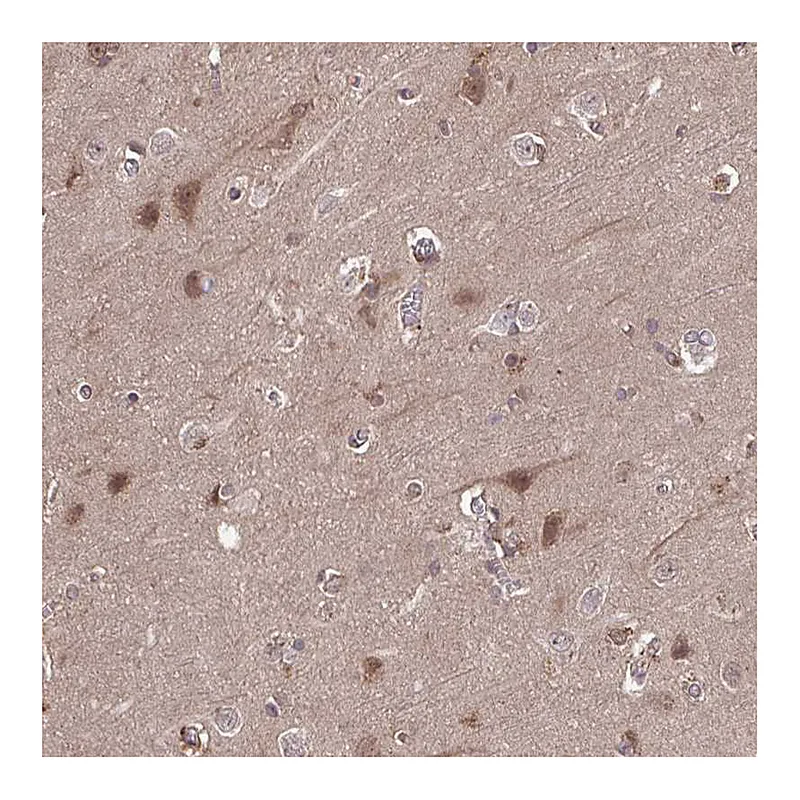 Atlas Antibodies Anti-TIGAR Antibody