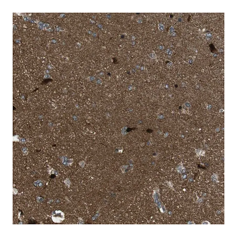 Atlas Antibodies Anti-TIAM2 Antibody