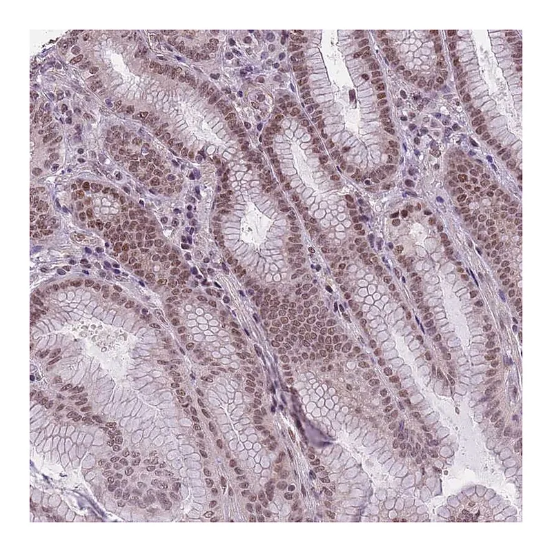 Atlas Antibodies Anti-TIGD1 Antibody