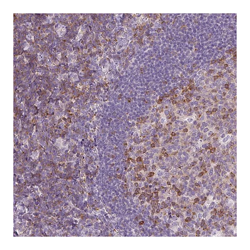 Atlas Antibodies Anti-TIGD2 Antibody