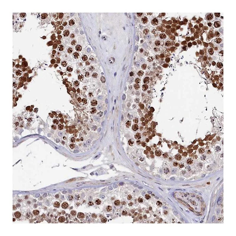 Atlas Antibodies Anti-TIGD4 Antibody