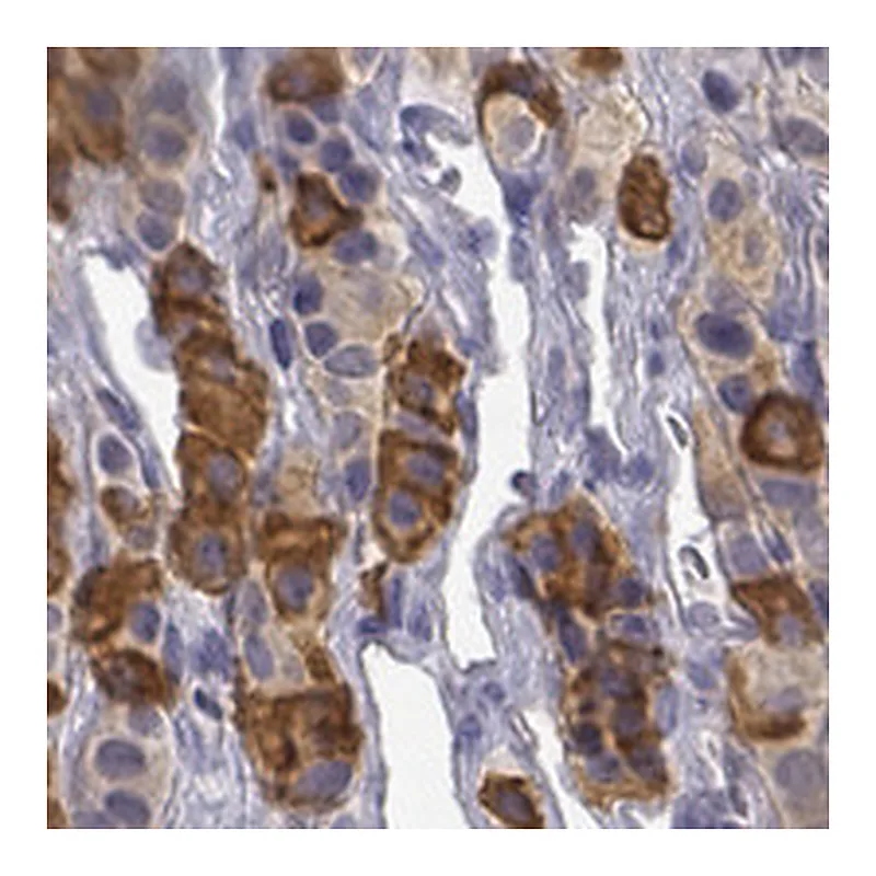 Atlas Antibodies Anti-TIGD4 Antibody