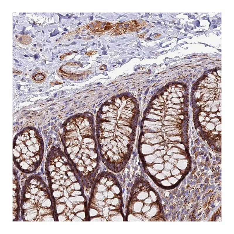 Atlas Antibodies Anti-TIGD6 Antibody