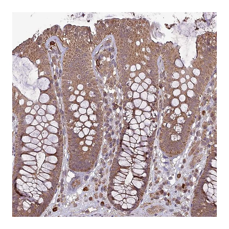 Atlas Antibodies Anti-TIGD7 Antibody