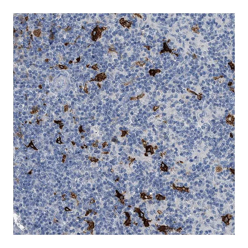 Atlas Antibodies Anti-TIMD4 Antibody