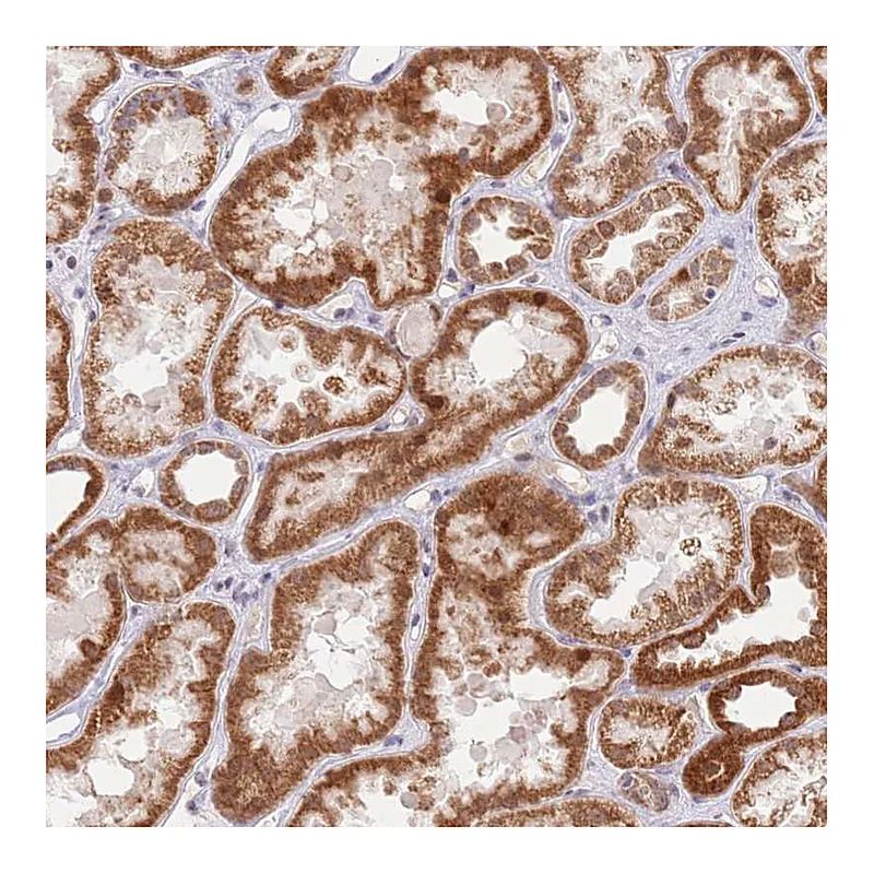 Atlas Antibodies Anti-TIMM13 Antibody
