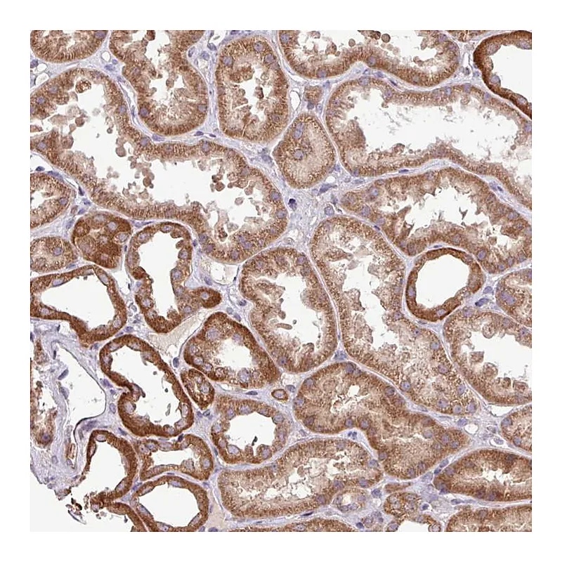 Atlas Antibodies Anti-TIMM10B Antibody