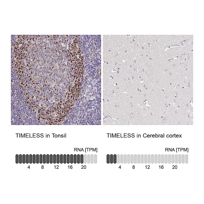 Atlas Antibodies Anti-TIMELESS Antibody
