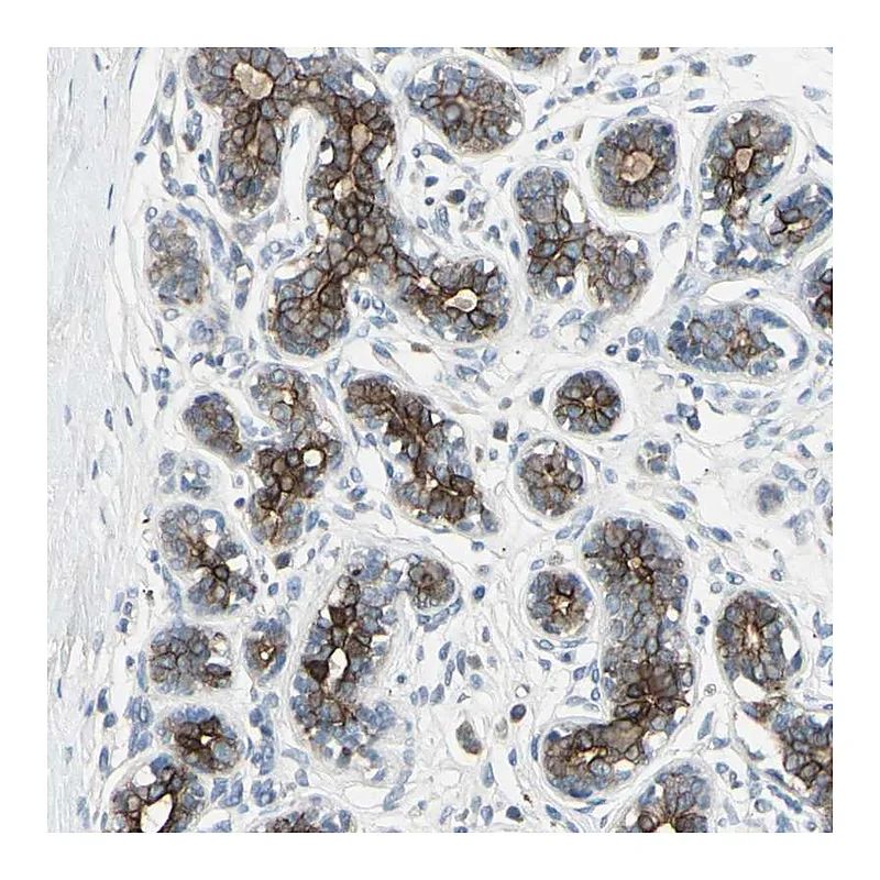 Atlas Antibodies Anti-TIMM21 Antibody