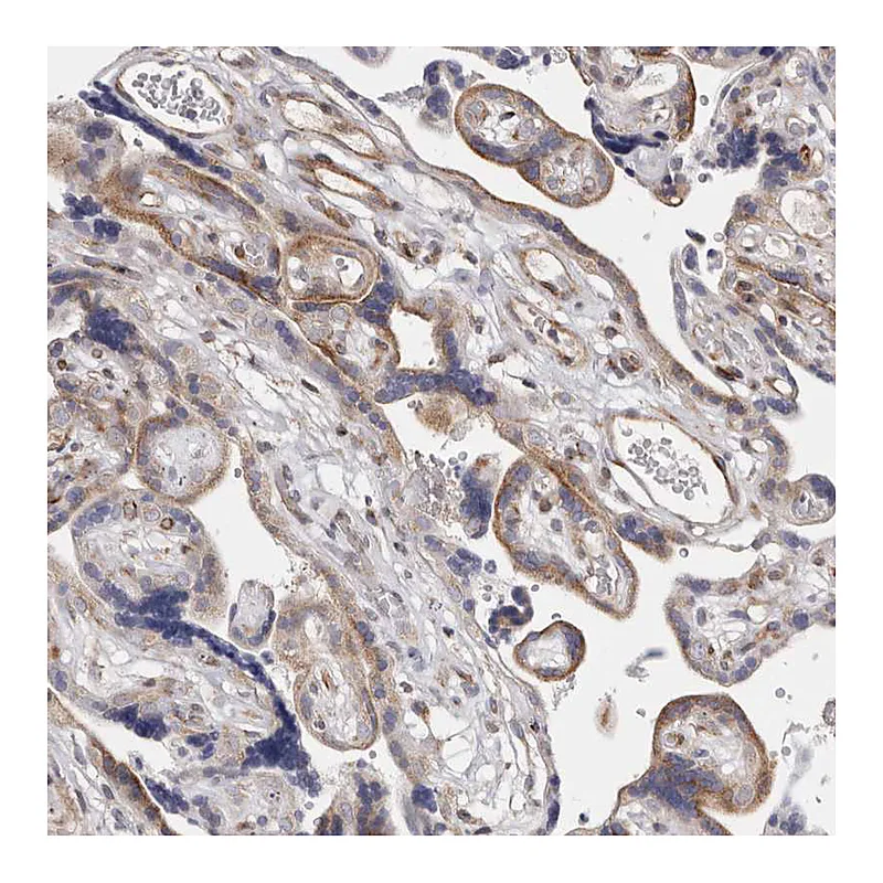 Atlas Antibodies Anti-TIMM17B Antibody