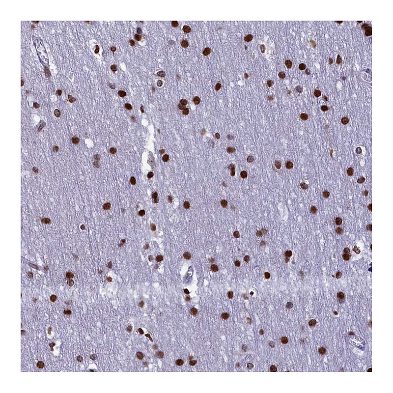 Atlas Antibodies Anti-TIMM29 Antibody