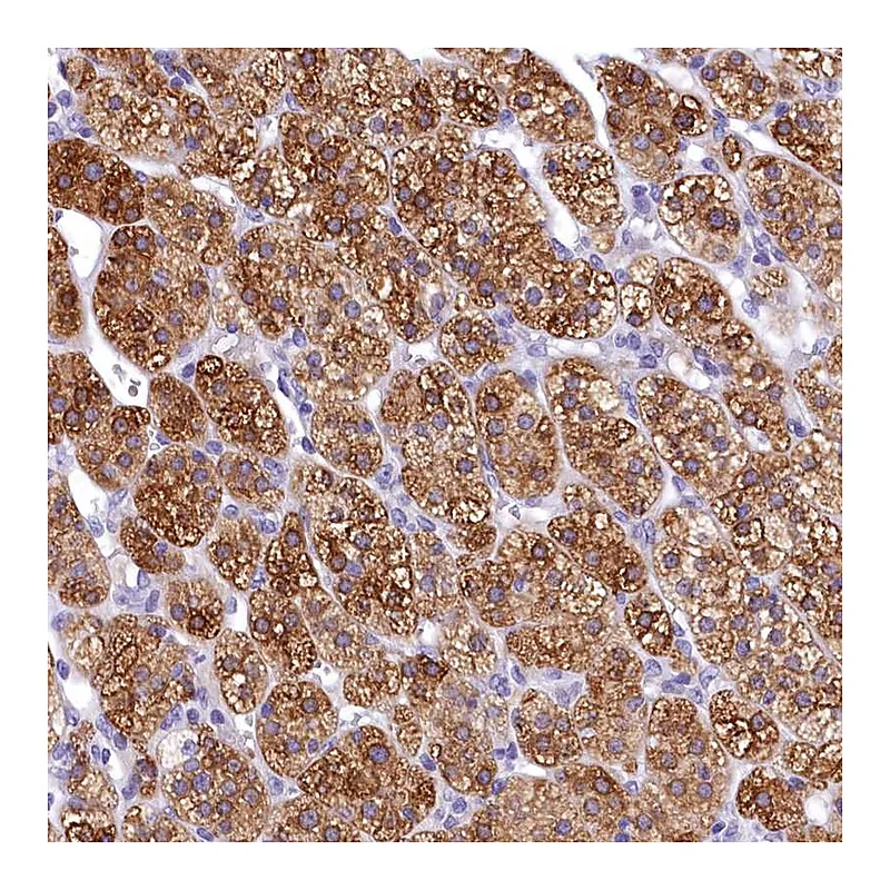 Atlas Antibodies Anti-TIMM22 Antibody
