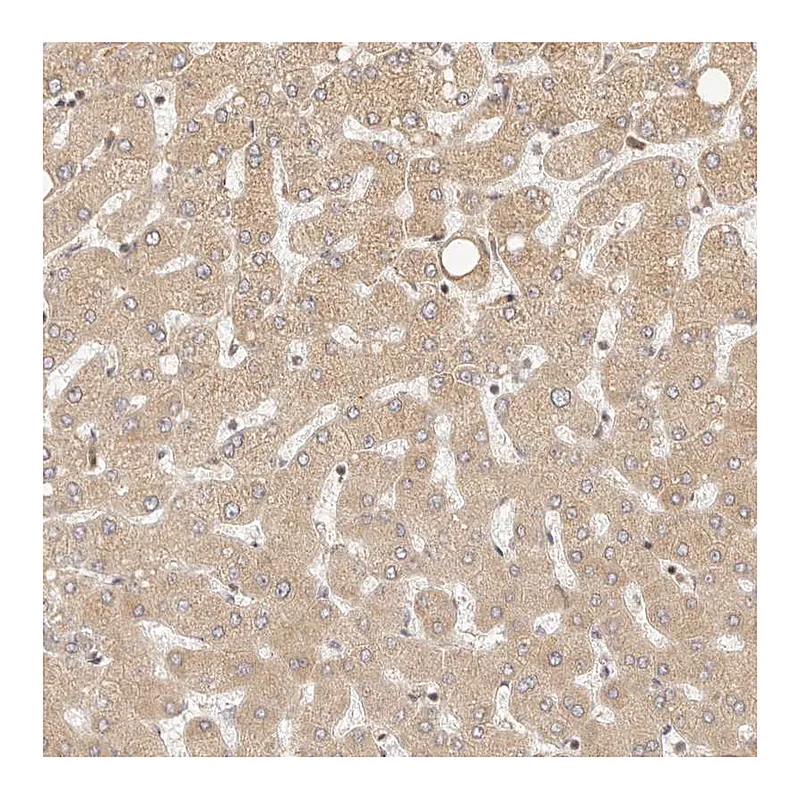 Atlas Antibodies Anti-TIMM17A Antibody