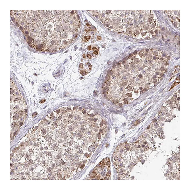 Atlas Antibodies Anti-TIMM50 Antibody