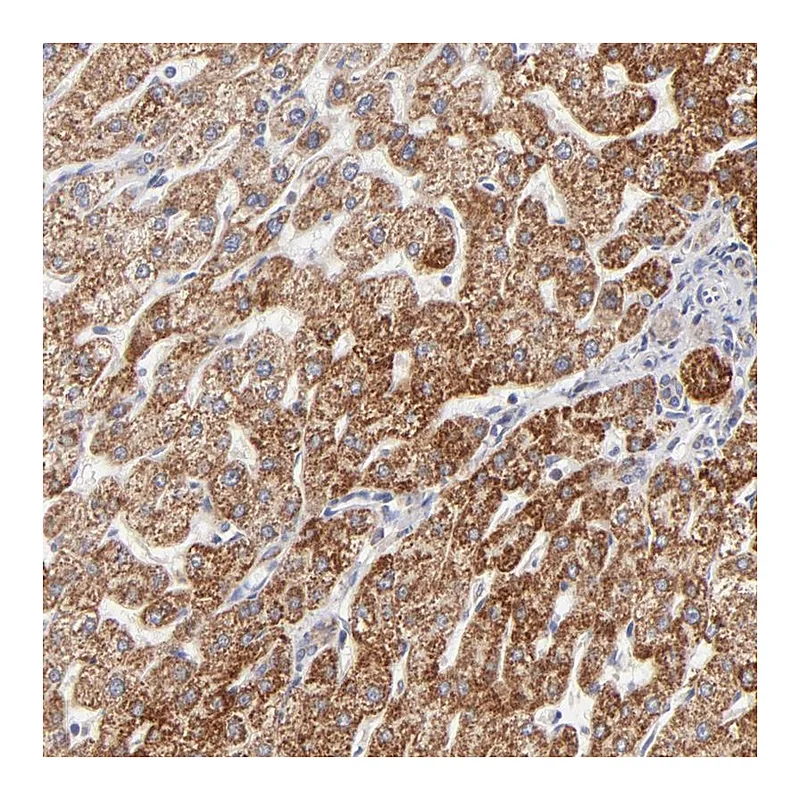 Atlas Antibodies Anti-TIMM8A Antibody