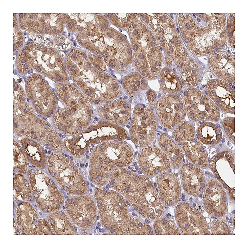Atlas Antibodies Anti-TIMM8B Antibody
