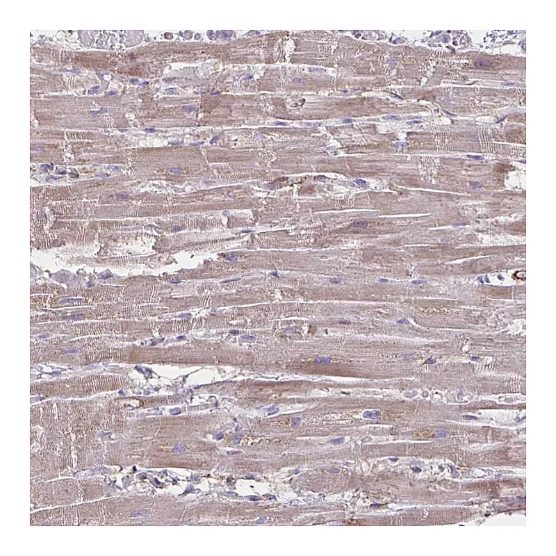 Atlas Antibodies Anti-TIMMDC1 Antibody