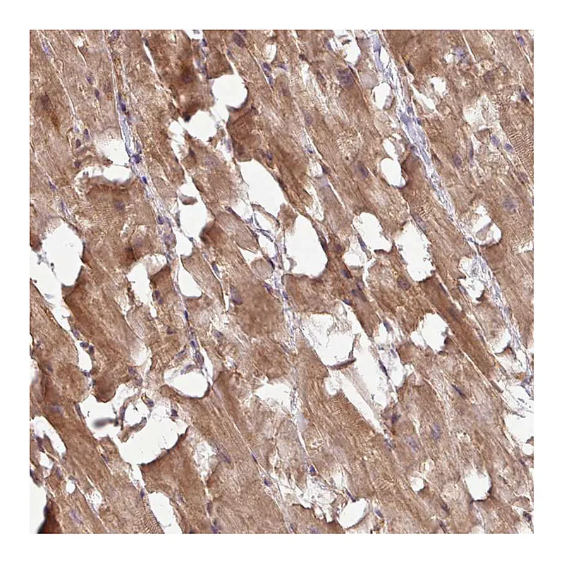 Atlas Antibodies Anti-TIMMDC1 Antibody