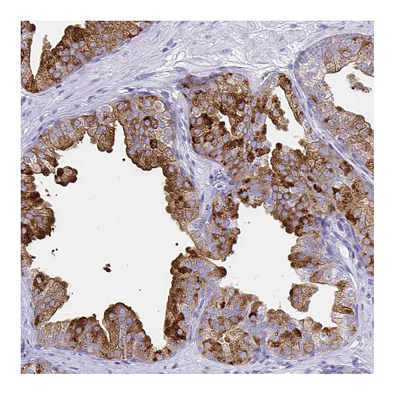 Atlas Antibodies Anti-TIMP1 Antibody
