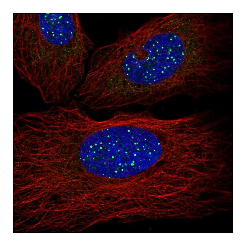 Atlas Antibodies Anti-TINF2 Antibody