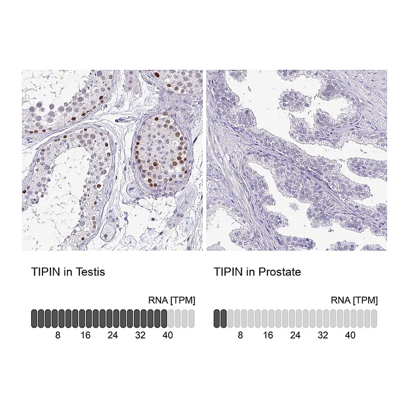 Atlas Antibodies Anti-TIPIN Antibody
