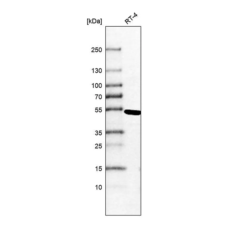 Atlas Antibodies Anti-TINF2 Antibody