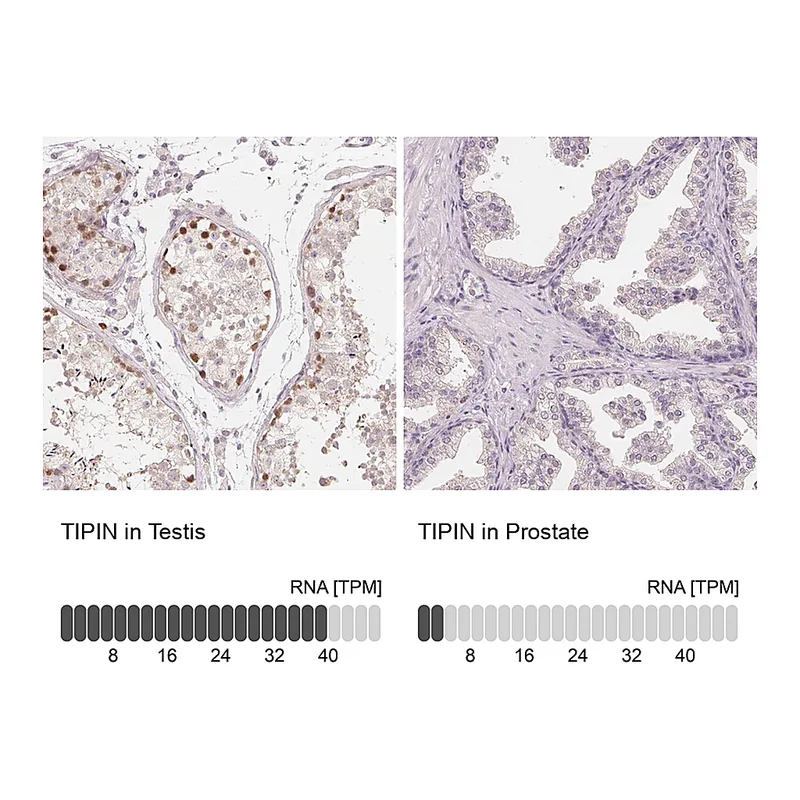 Atlas Antibodies Anti-TIPIN Antibody