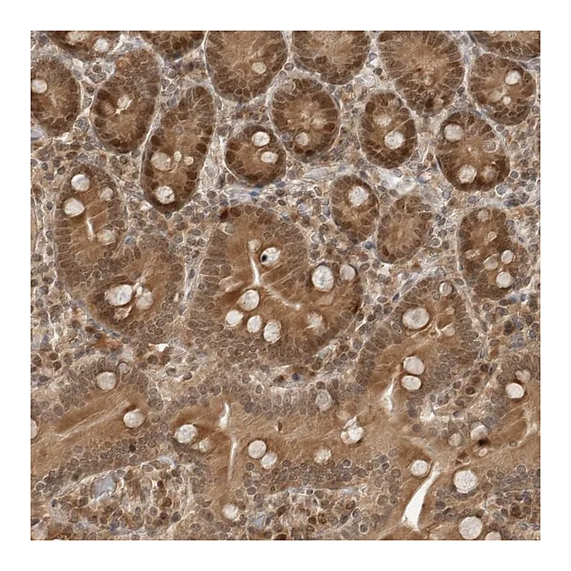 Atlas Antibodies Anti-TIPRL Antibody