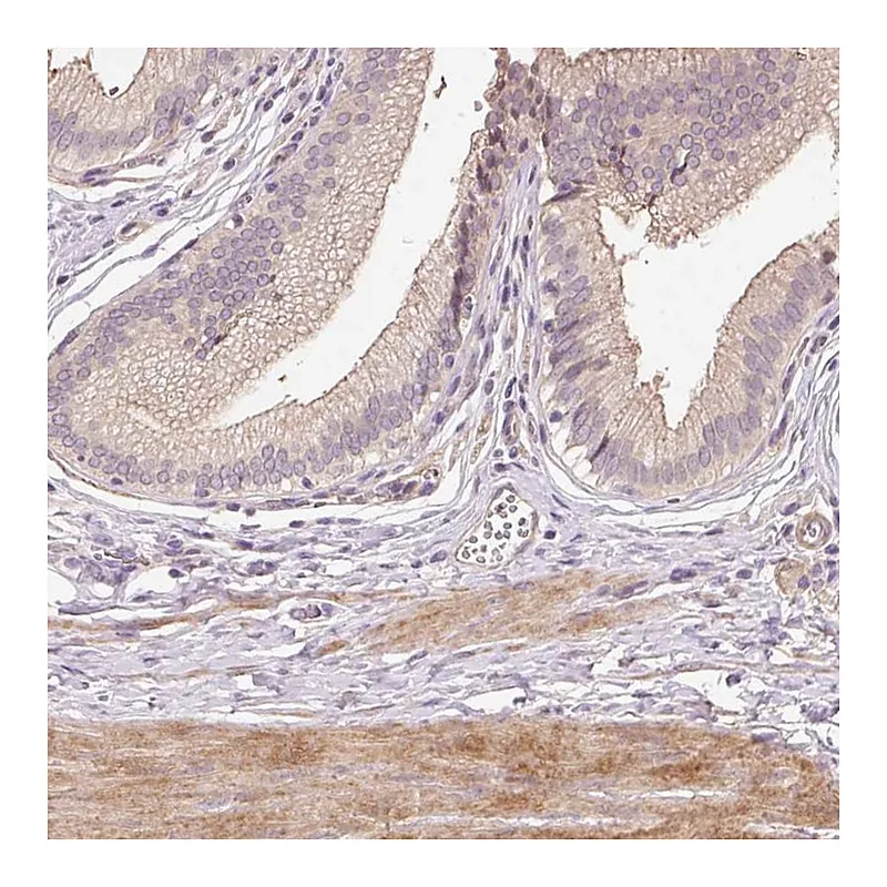 Atlas Antibodies Anti-TIRAP Antibody