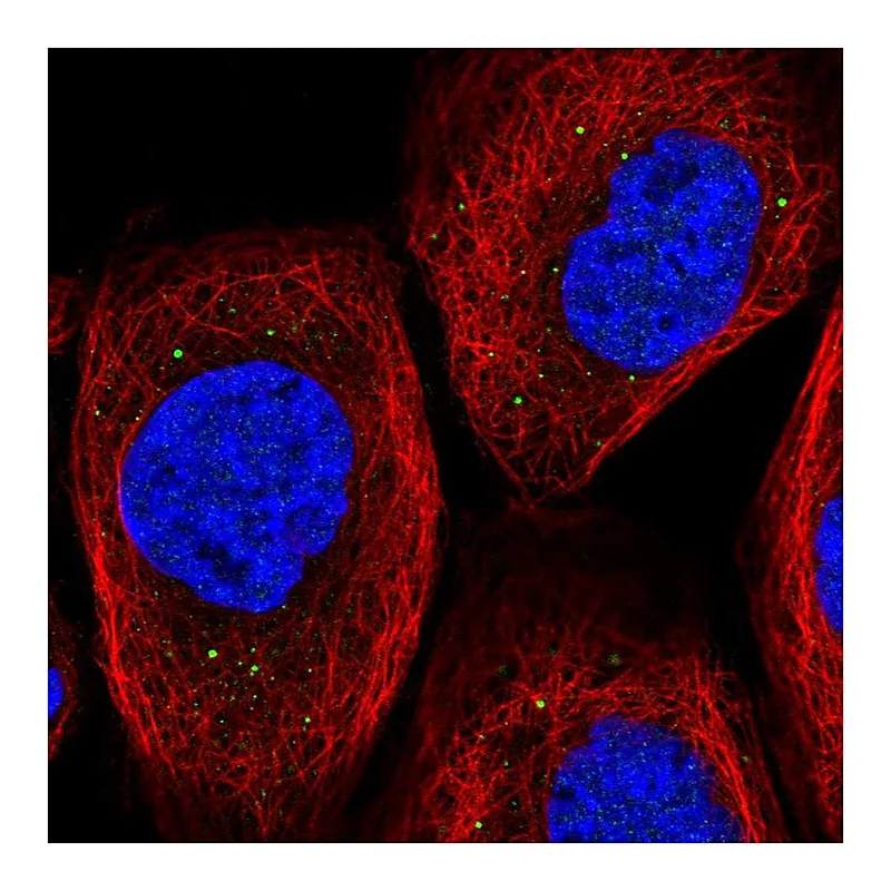 Atlas Antibodies Anti-TIPRL Antibody