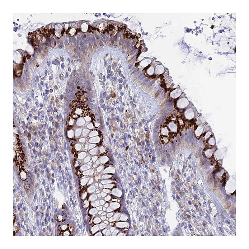 Atlas Antibodies Anti-TISP43 Antibody