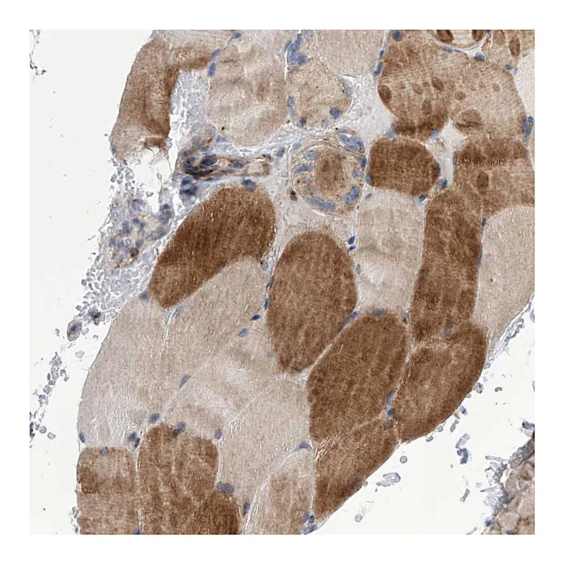 Atlas Antibodies Anti-TJAP1 Antibody