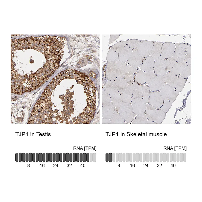Atlas Antibodies Anti-TJP1 Antibody