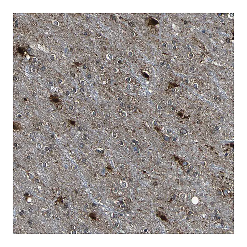 Atlas Antibodies Anti-TJP2 Antibody