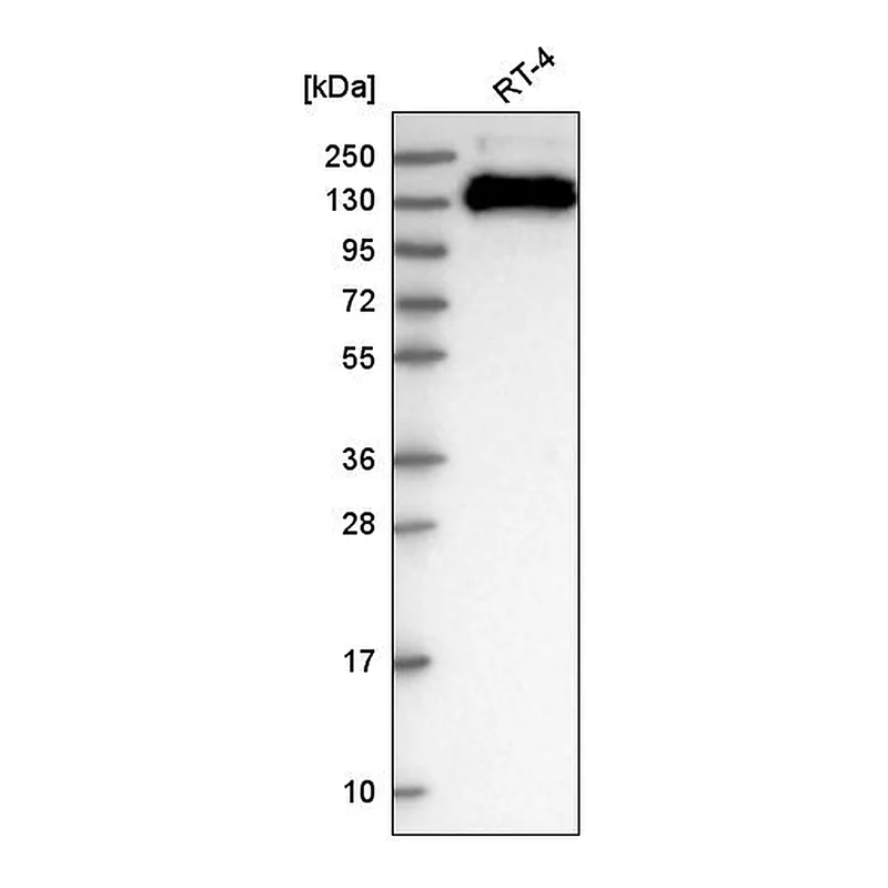 Atlas Antibodies Anti-TJP3 Antibody