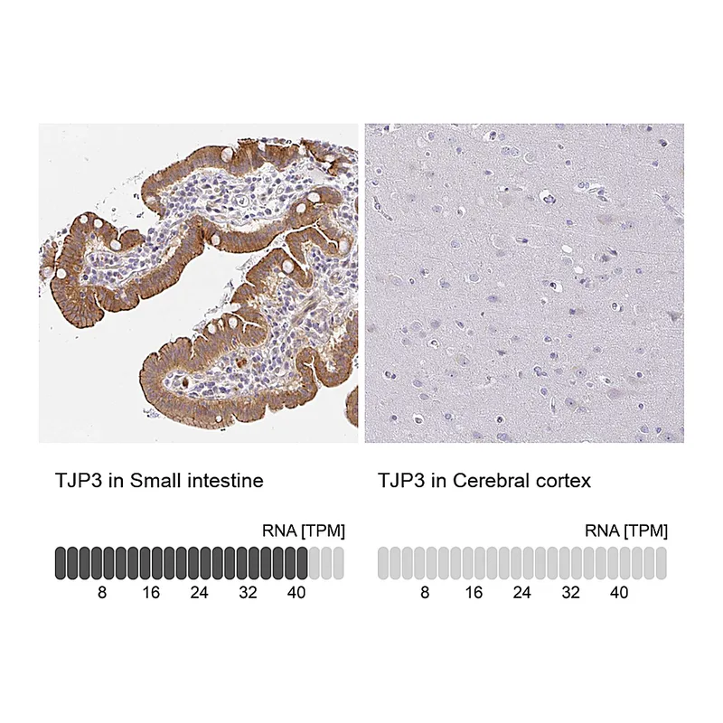 Atlas Antibodies Anti-TJP3 Antibody
