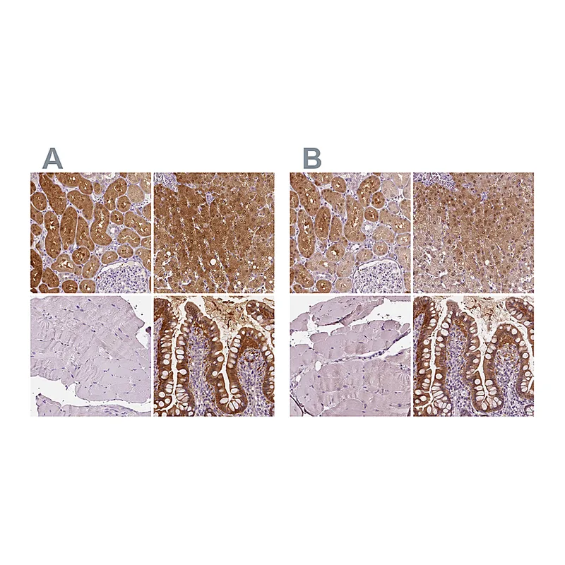 Atlas Antibodies Anti-TKFC Antibody