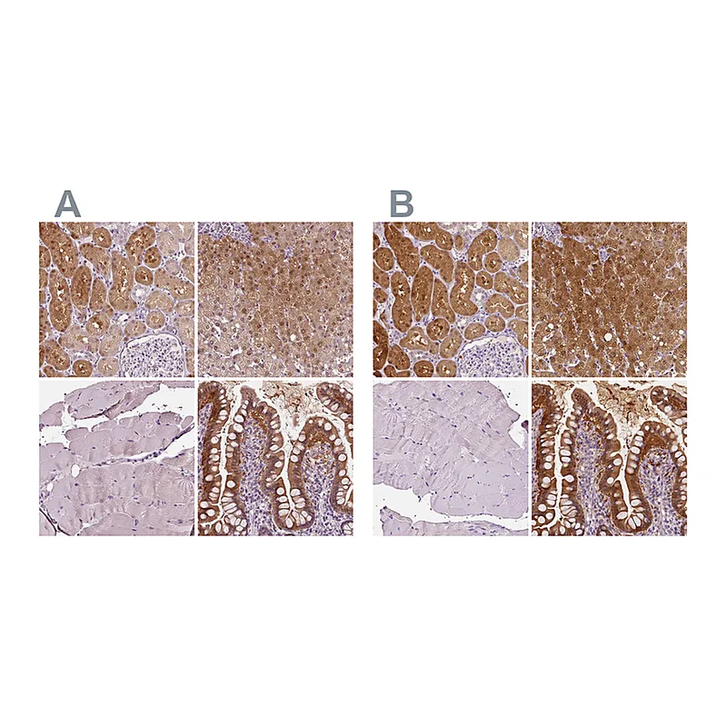 Atlas Antibodies Anti-TKFC Antibody