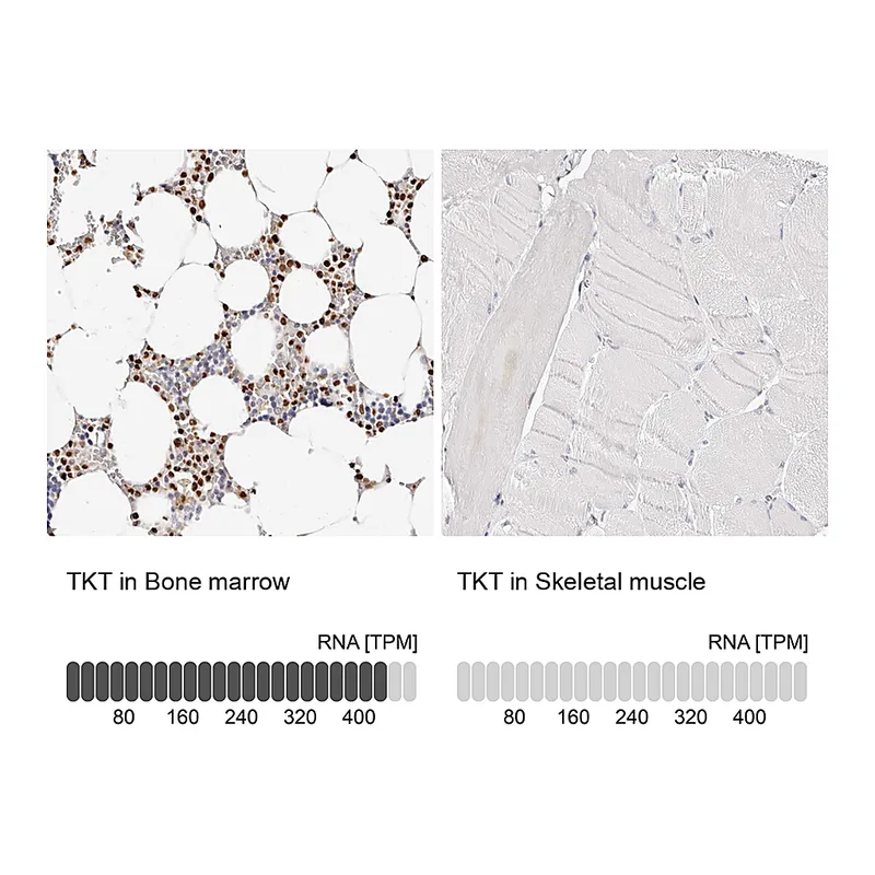 Atlas Antibodies Anti-TKT Antibody