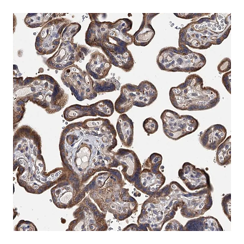 Atlas Antibodies Anti-TLDC1 Antibody