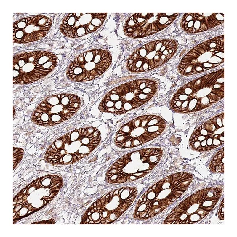 Atlas Antibodies Anti-TLDC2 Antibody