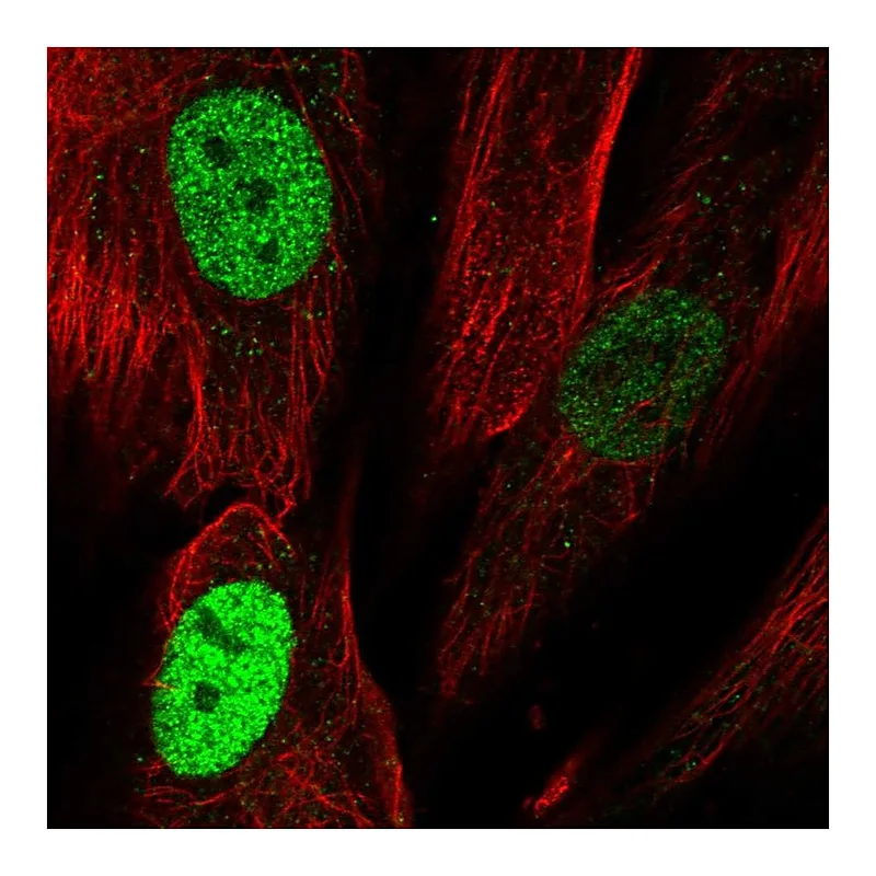 Atlas Antibodies Anti-TLE4 Antibody