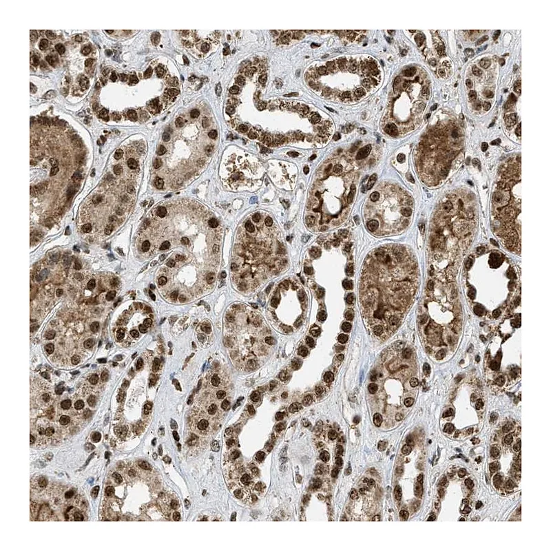 Atlas Antibodies Anti-TLK1 Antibody