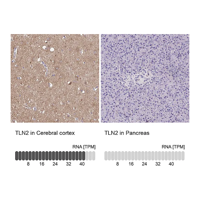 Atlas Antibodies Anti-TLN2 Antibody