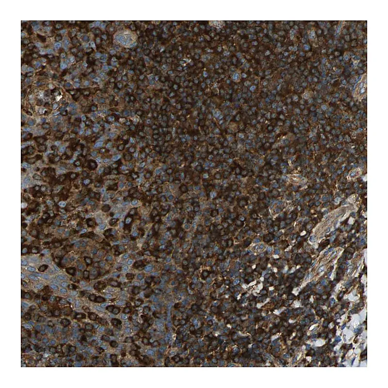 Atlas Antibodies Anti-TLN1 Antibody